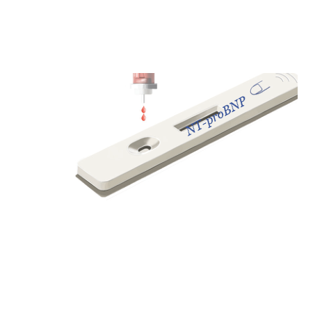 test-nt-probnp-rl-a2000-01.png